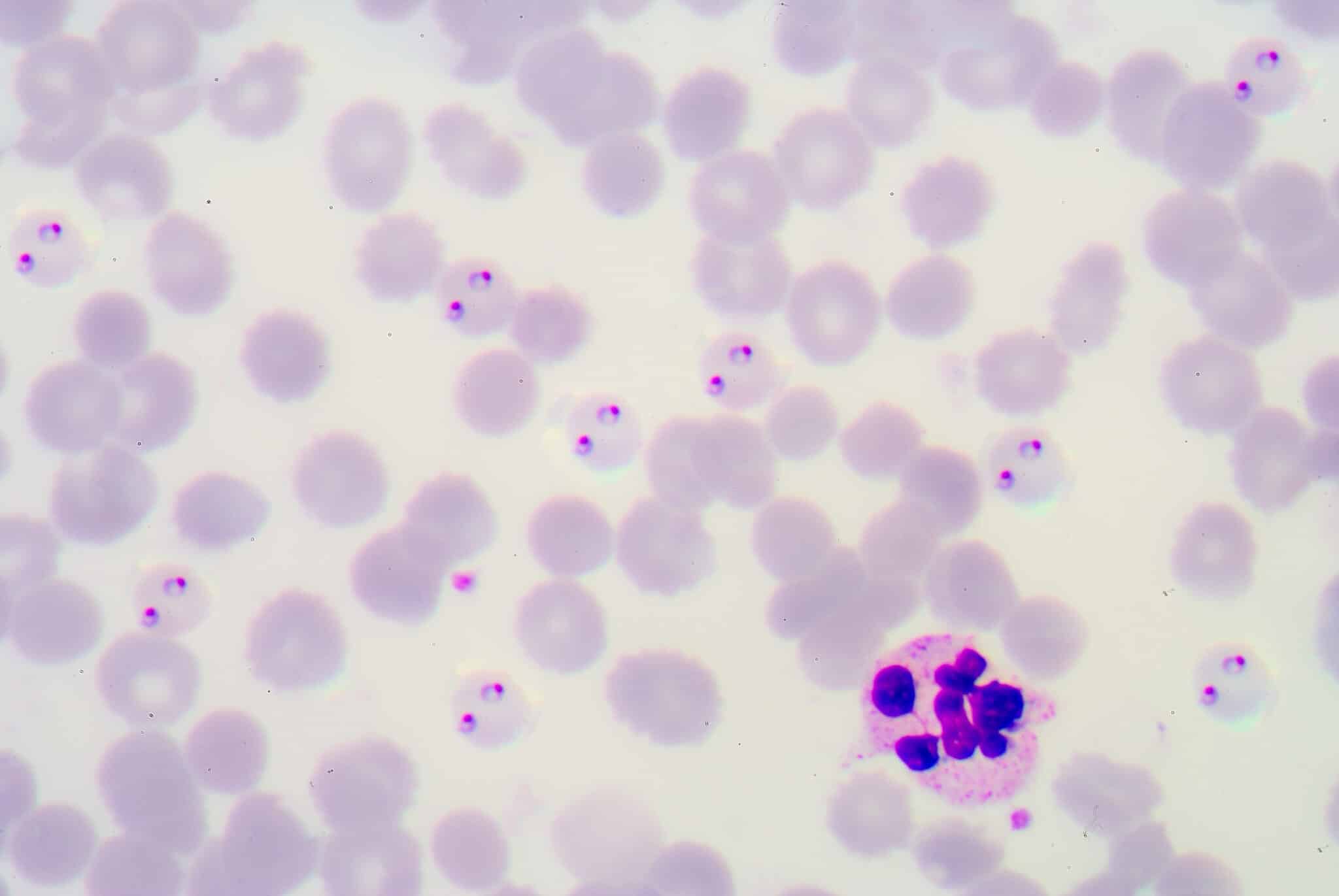 Film di sangue per parassiti della malaria 