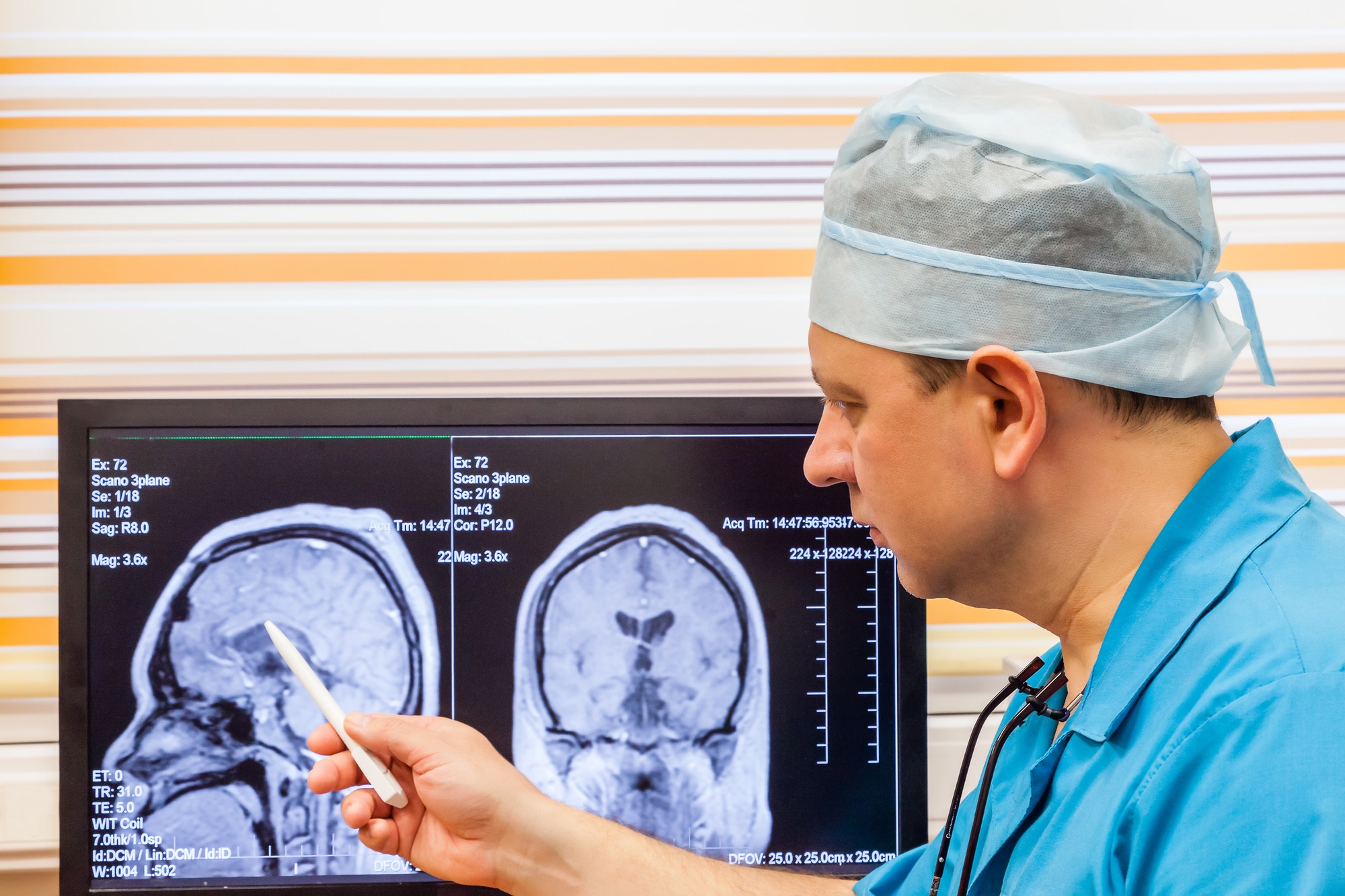 Dottore che esamina un esame MRI al cervello