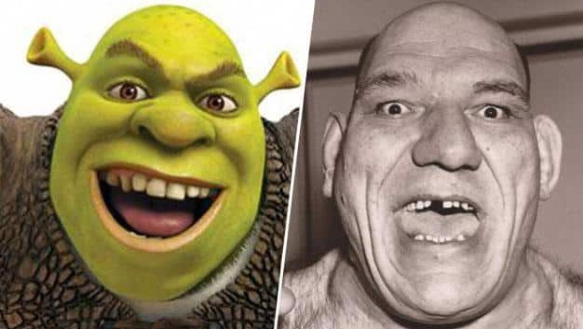Acromegalia: l'uomo che ha ispirato Shrek ne era affetto - 