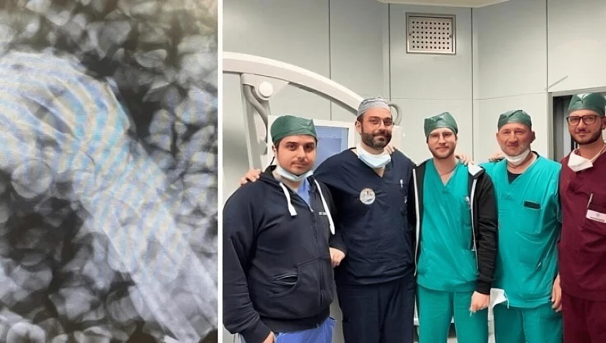 Il reimpianto di un braccio amputato: è accaduto a Bari - 