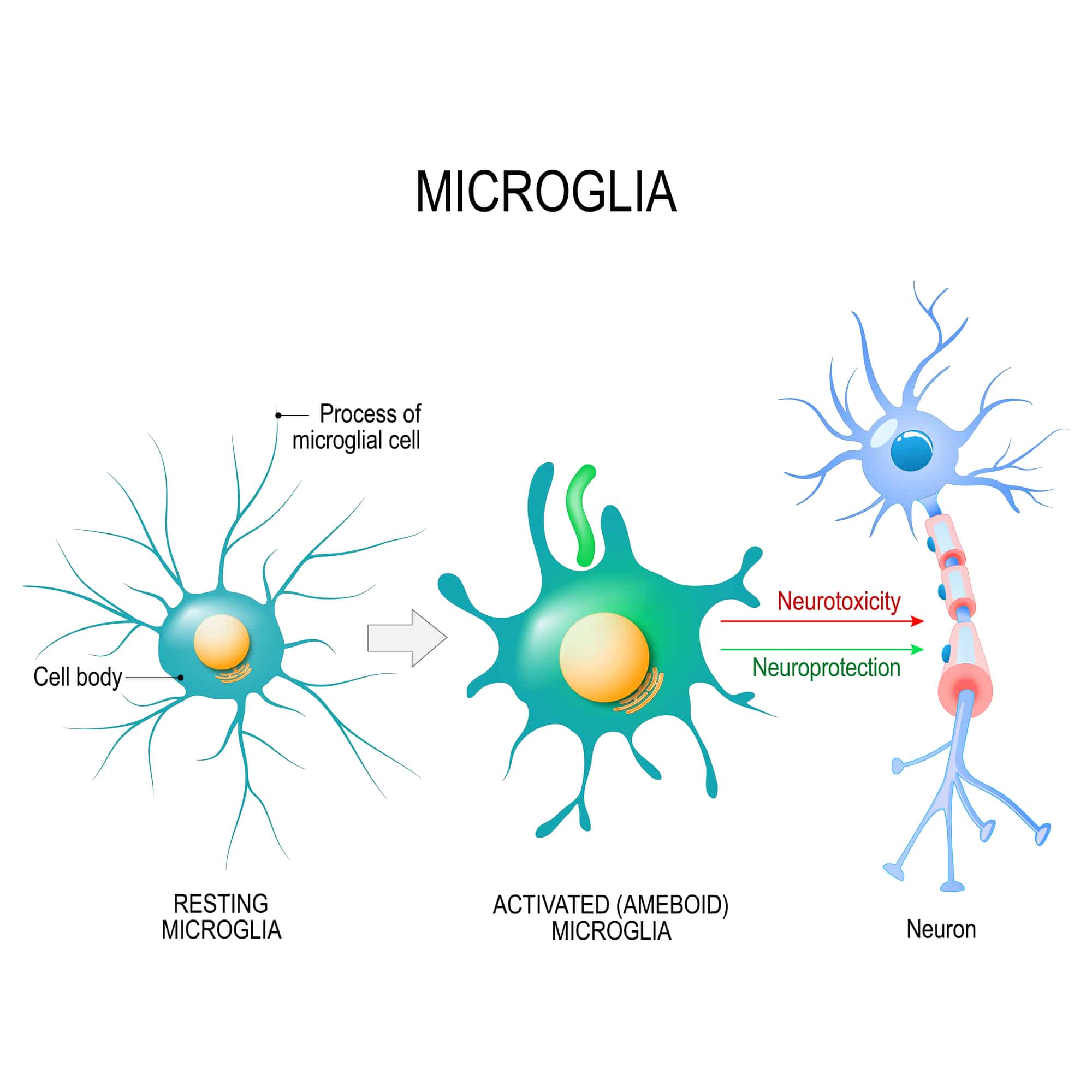 Attivazione di una cellula microgliale.