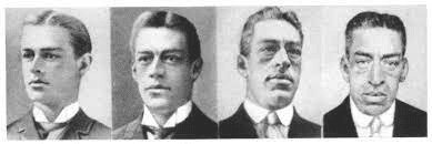 Credits: Centro Tumori dell'ipofisi