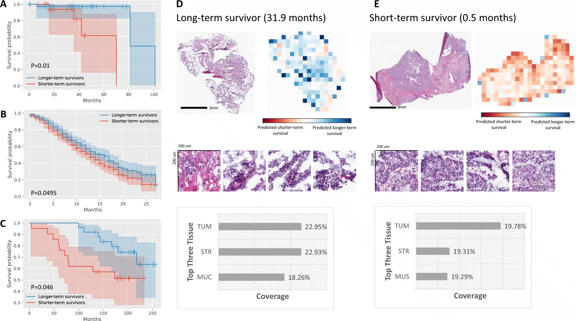 MOMA prevede gli esiti complessivi di sopravvivenza dei pazienti con cancro colon-retto in stadio I e II utilizzando immagini istopatologiche digitali, con convalida in più coorti indipendenti - Credits: Nature