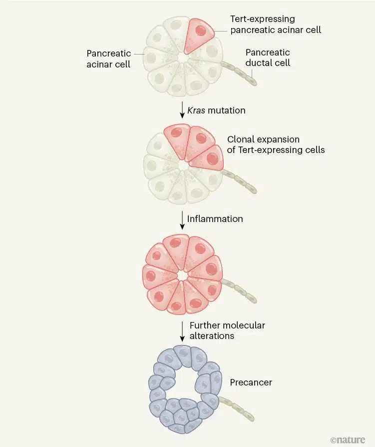 Primi eventi del percorso di creazione di un tumore pancreatico - Credits: Nature