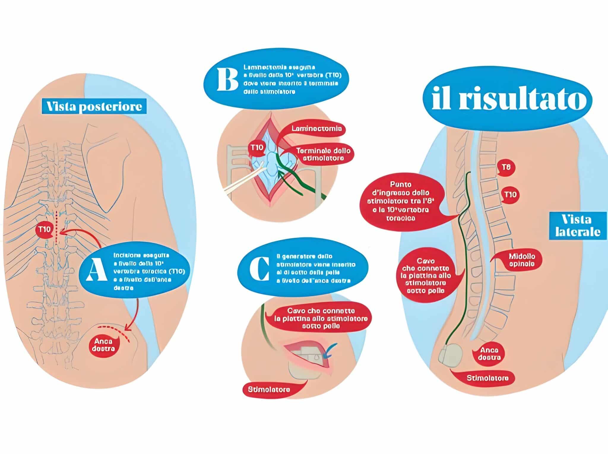 Credits- Corriere della Sera/ Descrizione dell'intervento