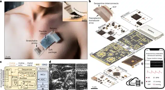 Panoramica del nuovo prototipo di ecografo indossabile - Credits: Nature Biotechnology