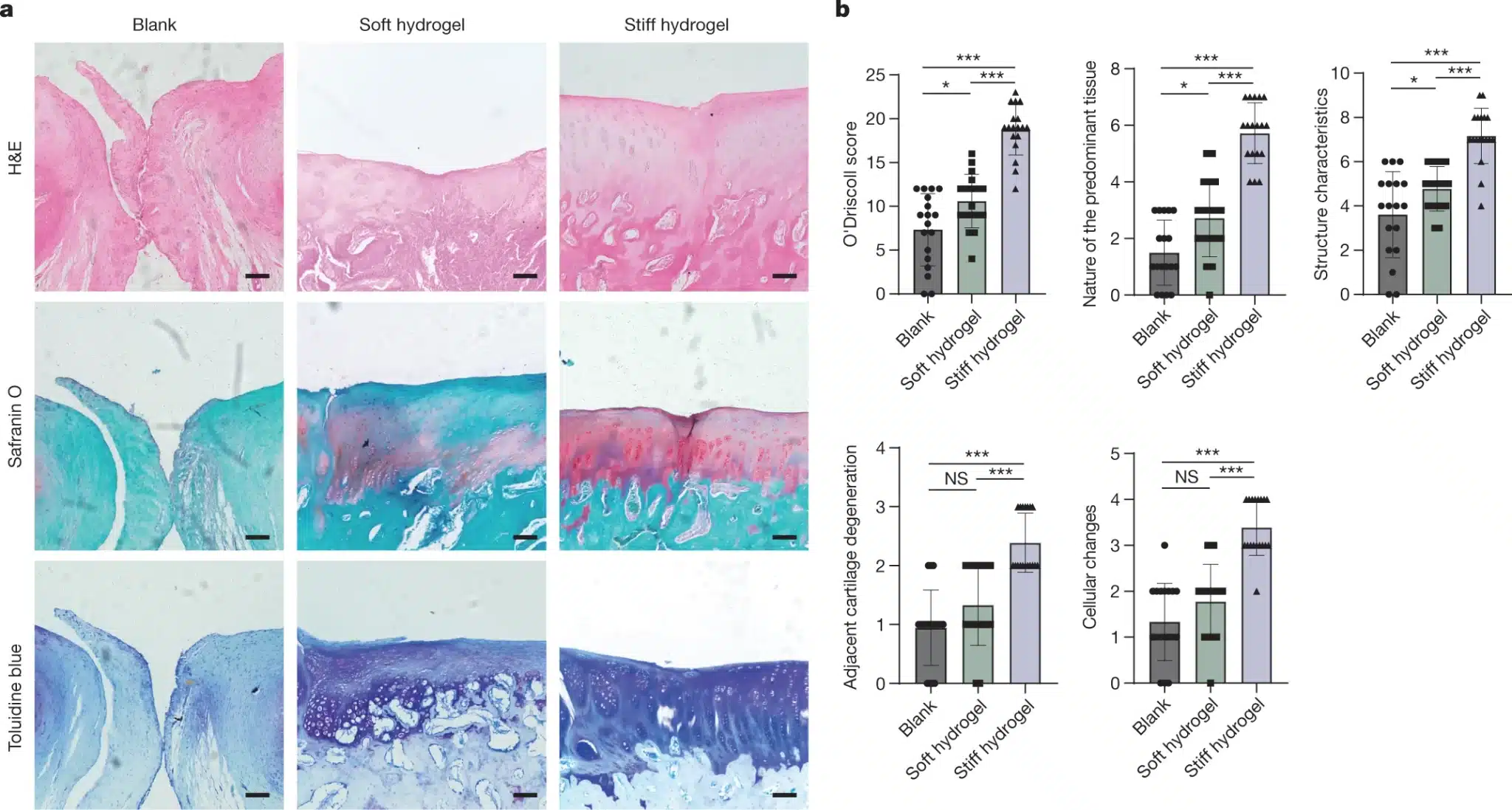 L'analisi istologica mostra un miglioramento significativo della riparazione dell'osso subcondrale e della cartilagine nel gruppo con iniezione di hydrogel rigido a 12 settimane dopo l'impianto - Credits: Nature
