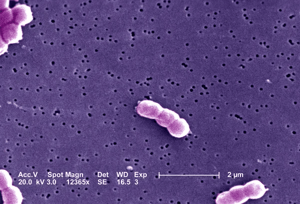 Acinetobacter al microscopio