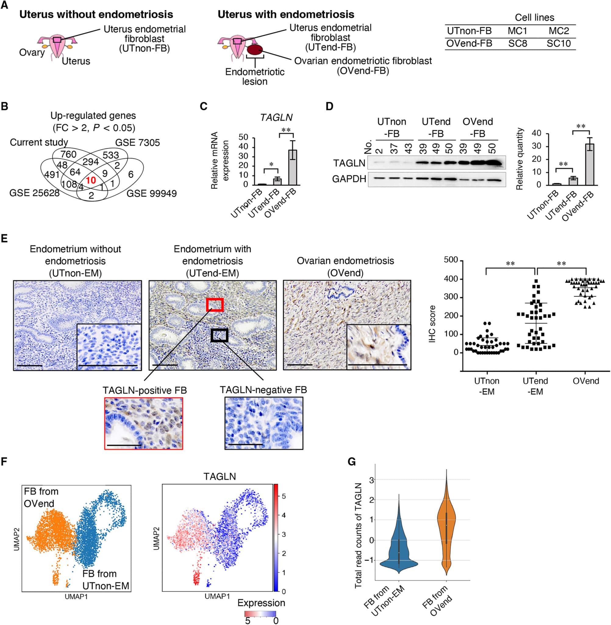Up-regulation di TAGLN in pazienti con endometriosi - Credits: SCIENCE TRANSLATIONAL MEDICINE