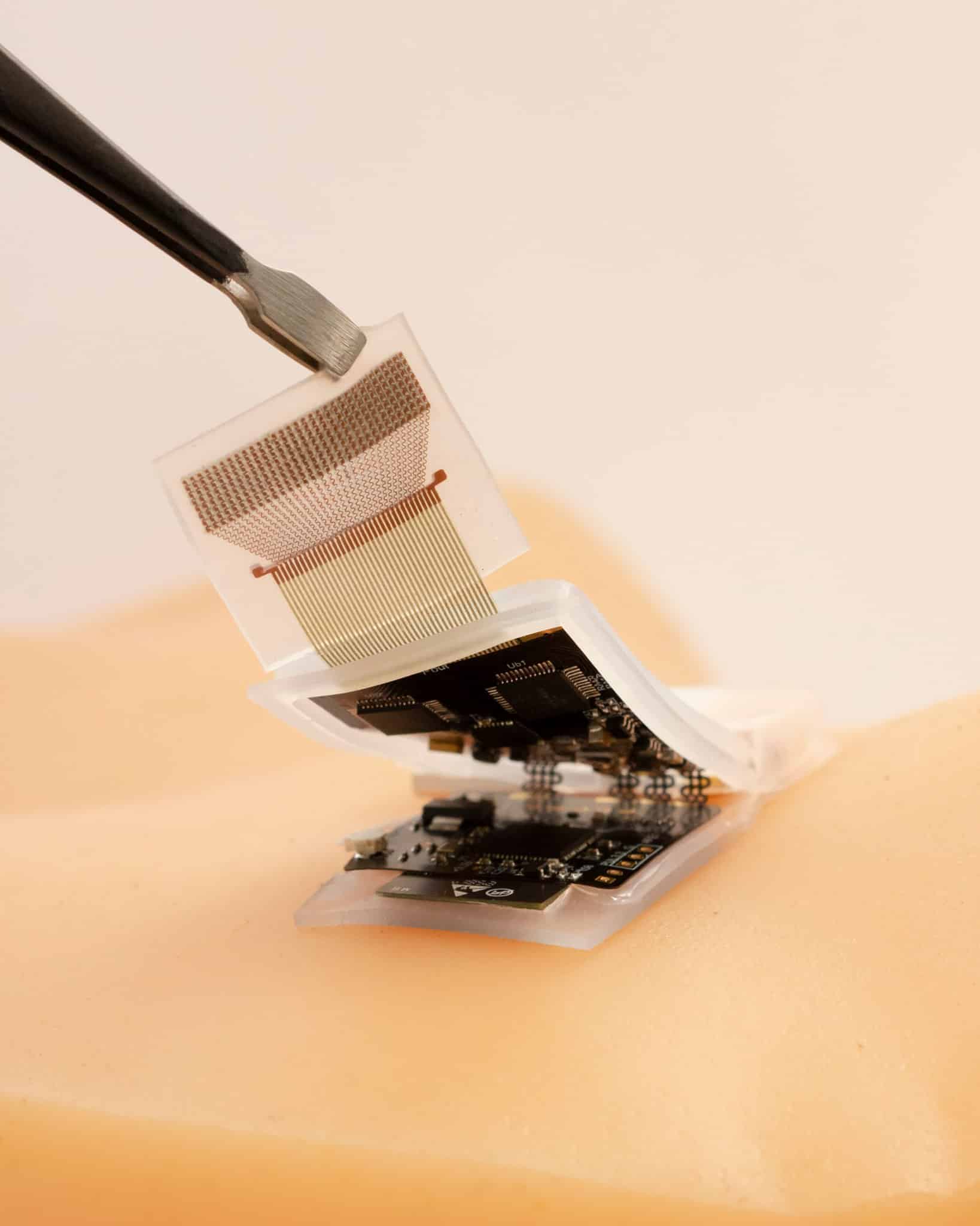 Il nuovo prototipo di ecografo indossabile - Credits: UC San Diego Jacobs School of Engineering