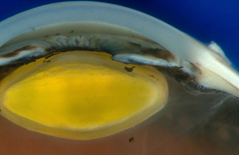 In foto è visibile la parte anteriore dell'occhio - Credit: Ralph C. Eagle Jnr/Science Photo Library