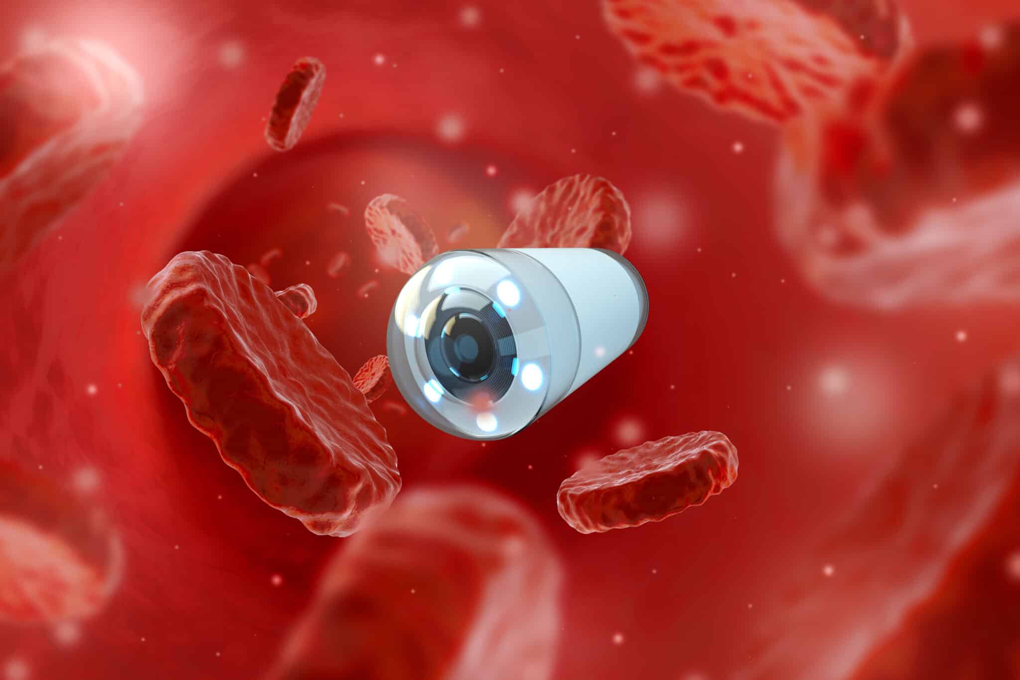videocaspula per gastroscopia