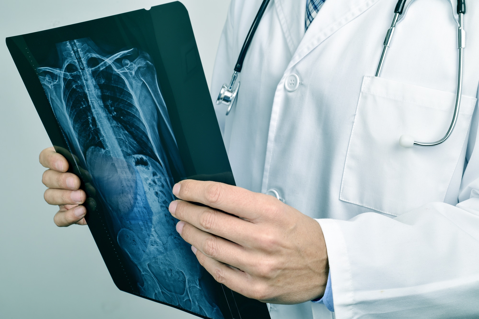 Medico che analizza radiografia toracica.