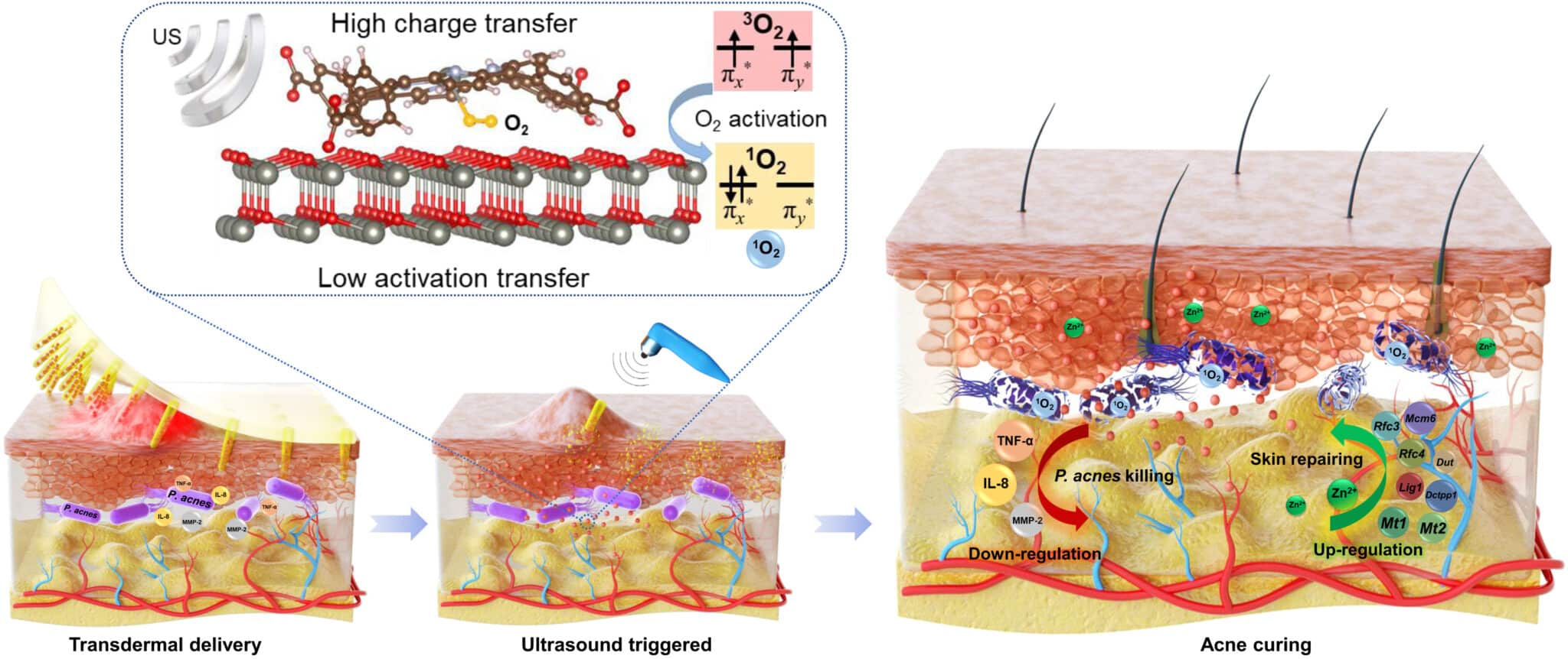 Diagramma schematico del nuovo studio con cerotto per trattare l'acne - Credits: Science Advances