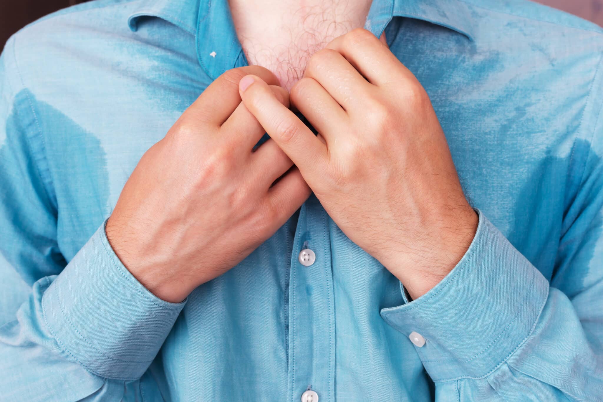 terapia per l'iperidrosi