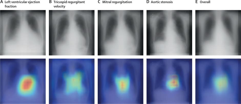 Immagini realizzate durante lo studio - Credits: The Lancet Digital Health