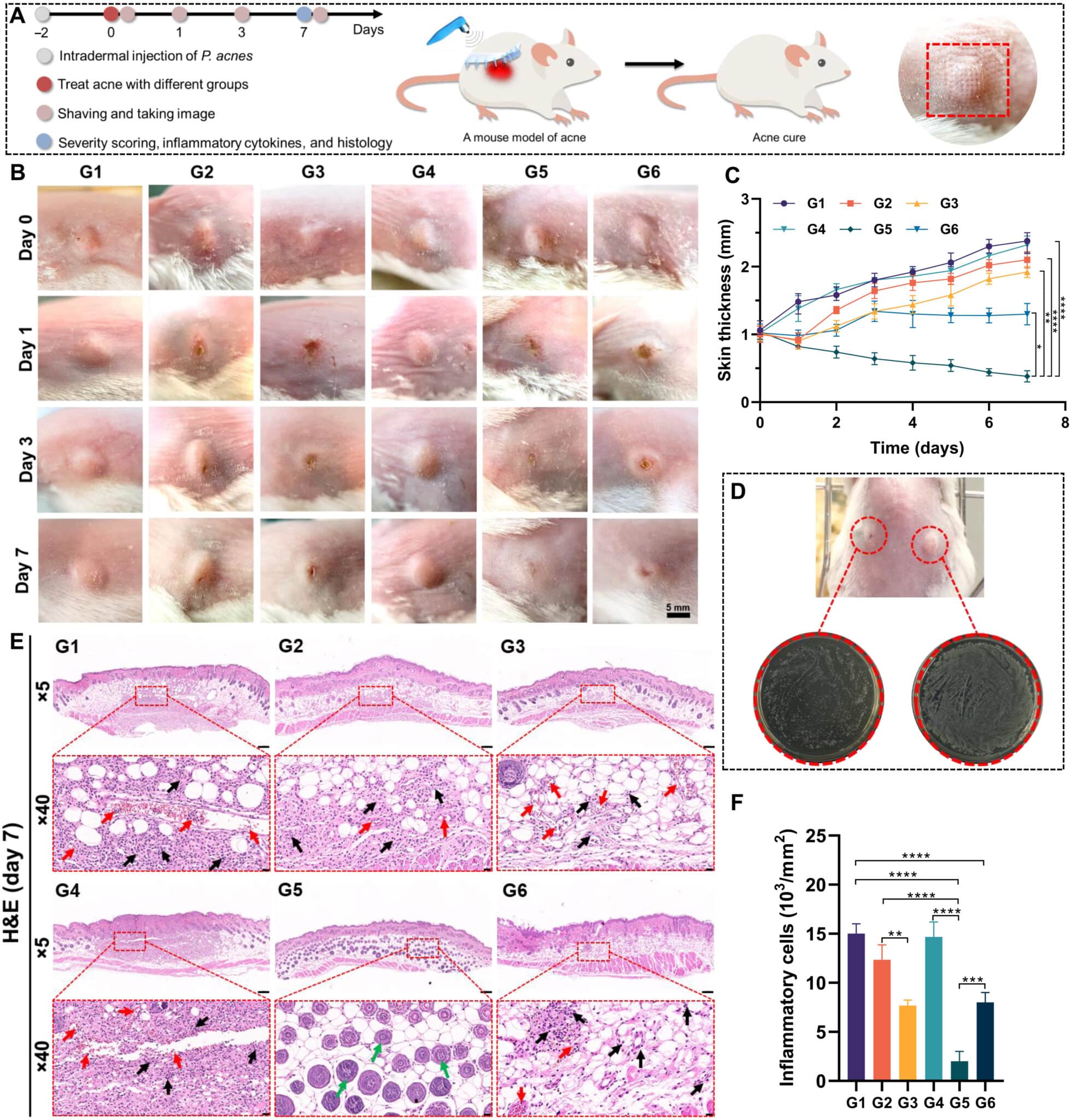 Mitigazione dell'acne tramite diversi cerotti con microaghi su topi - Credits: Science Advances
