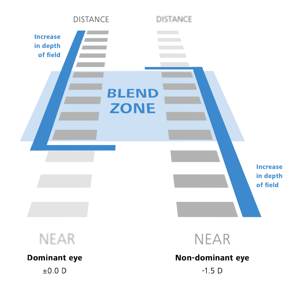PRESBYOND: la BLEND ZONE - Credits: Zeiss