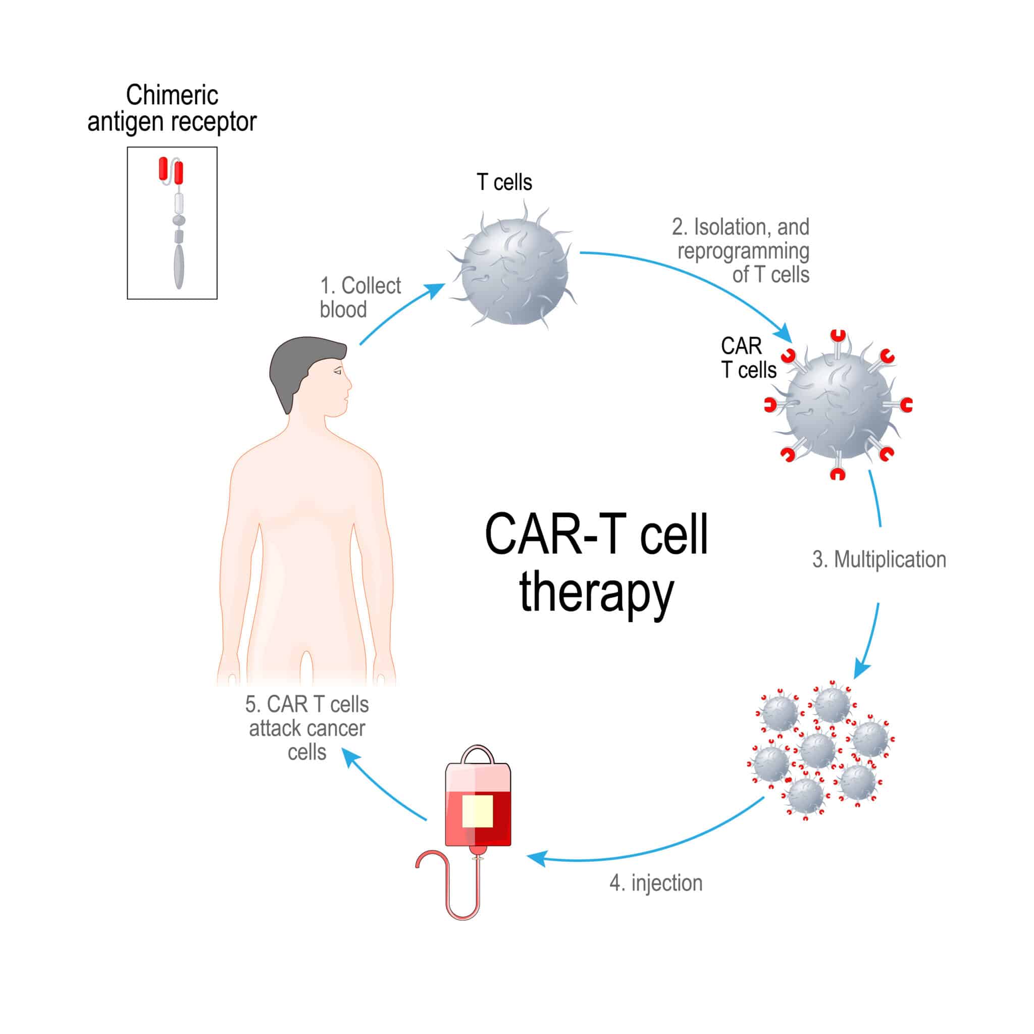 Mesotelioma: nuove strategie terapeutiche