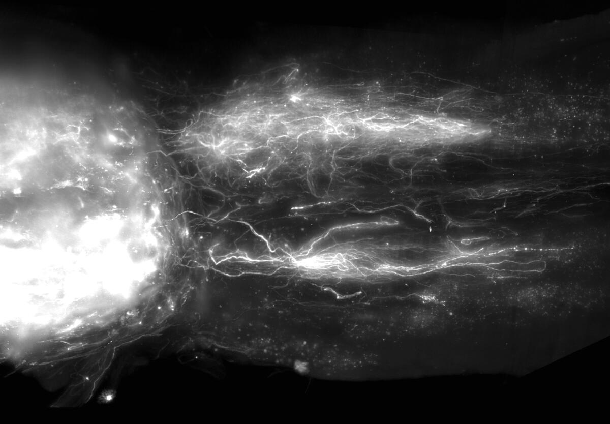 Paralisi: terapia genica mirata permette movimento nei topi - paralisi - Credits: EPFL