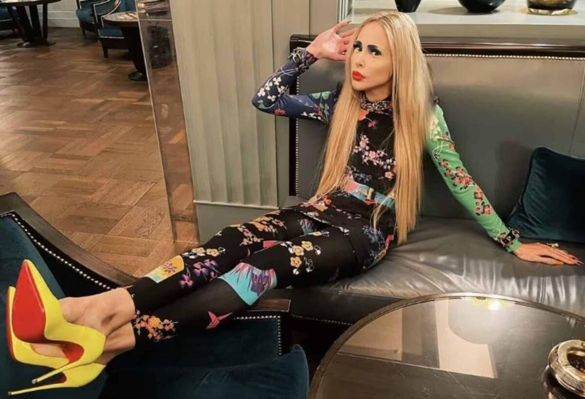 Allungamento delle gambe: l'intervento drastico della modella Theresia Fischer - 