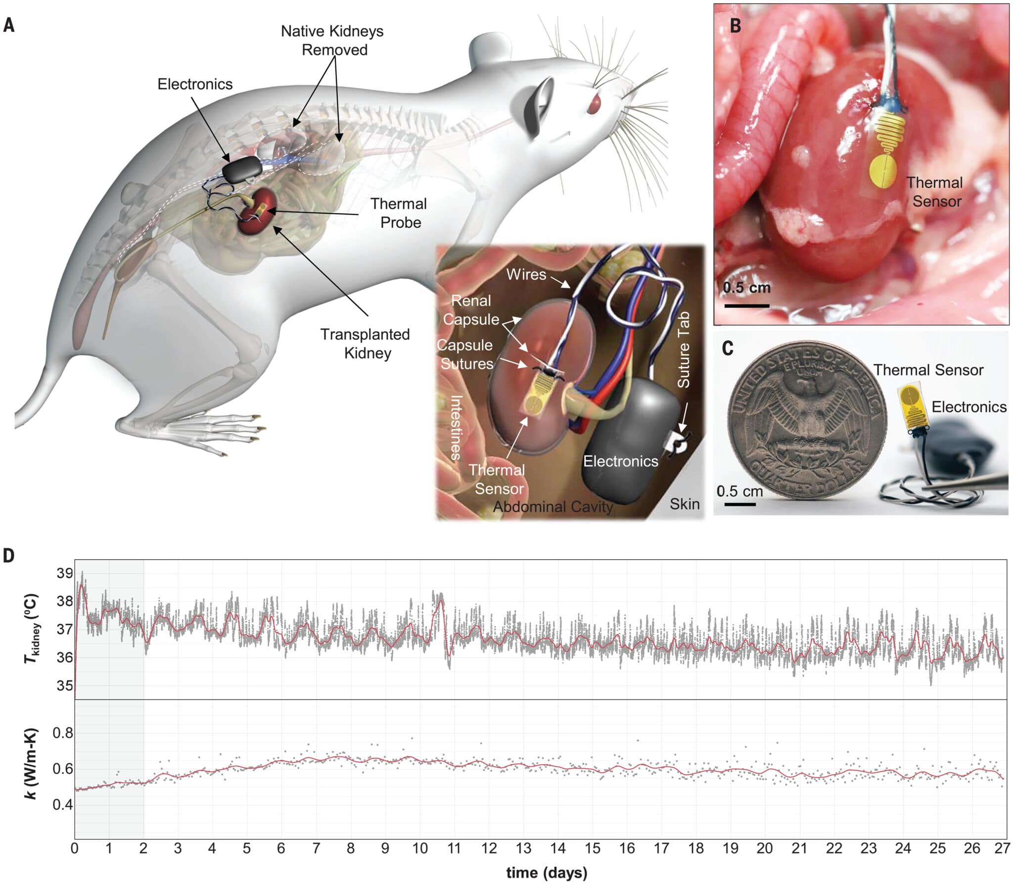 Monitoraggio del rigetto del trapianto di rene utilizzando un sistema bio-elettronico impiantabile in vivo su ratti - Credits: Science