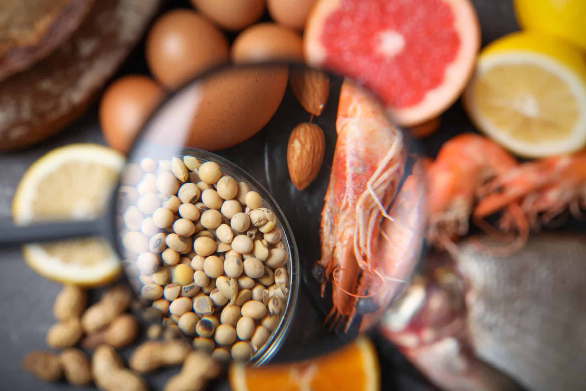 allergie alimentari