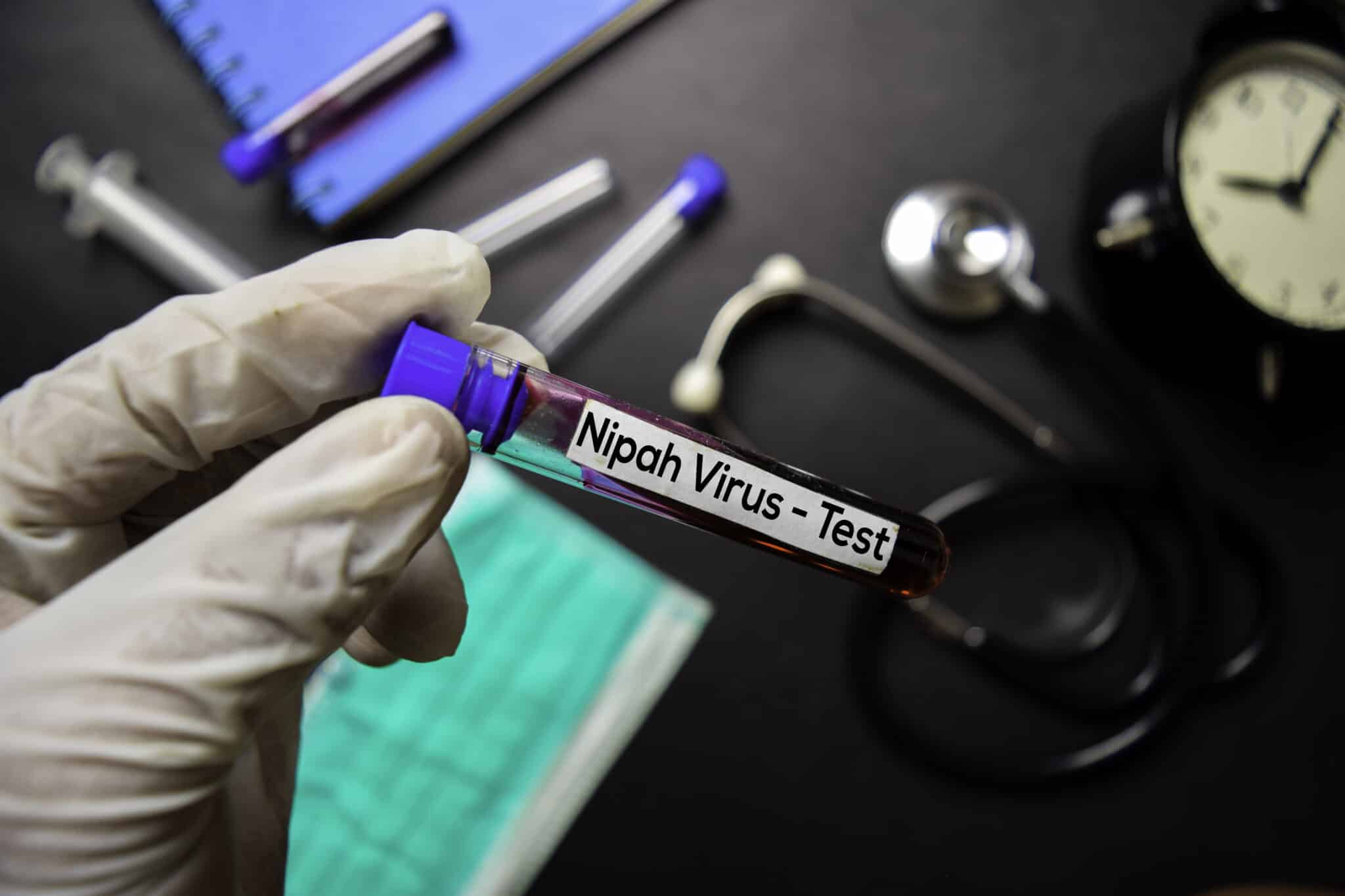 virus Nipah