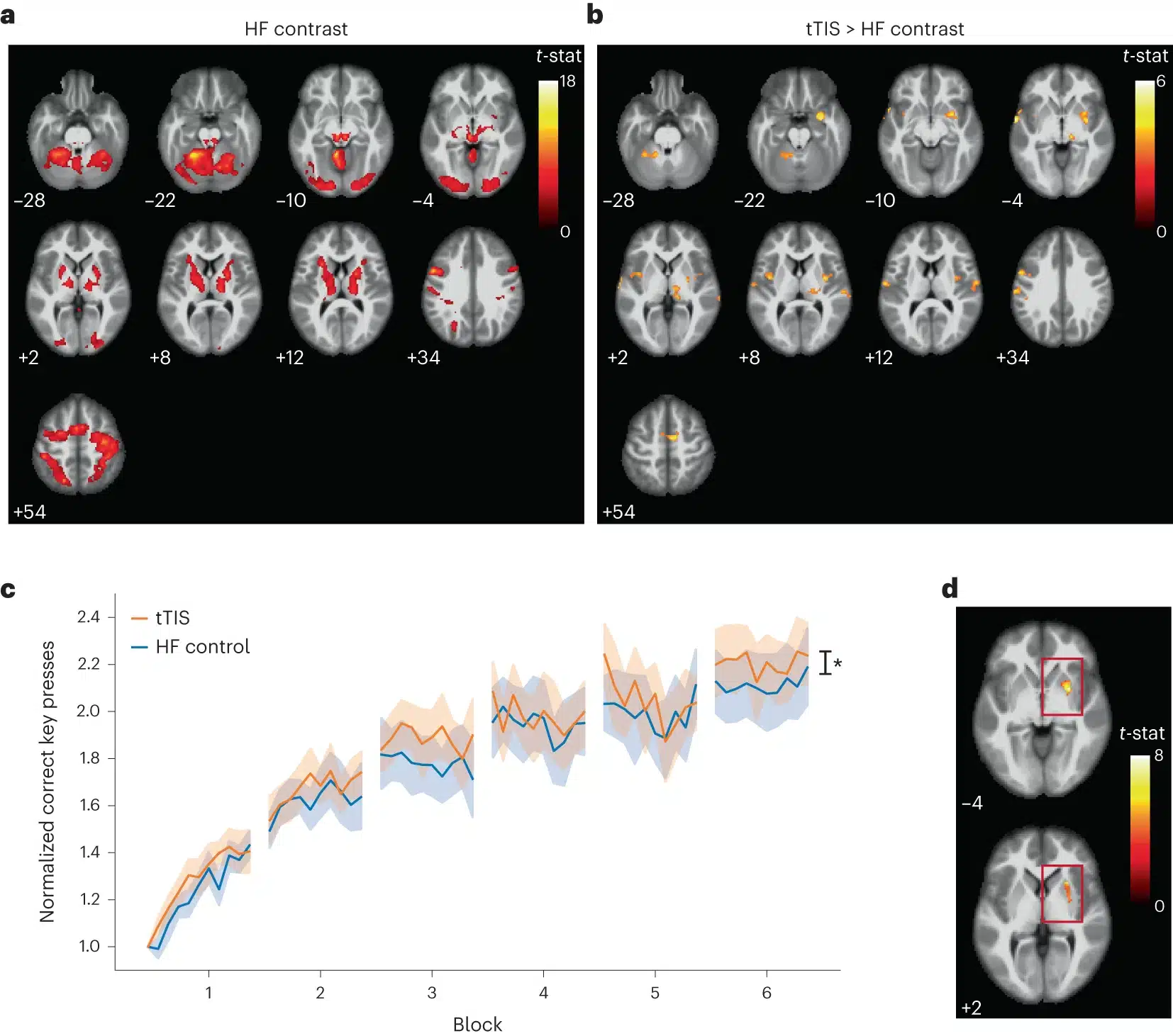 Risultati dell'esperimento fMRI basato sull'attività di rete - Credits: Nature Neuroscience