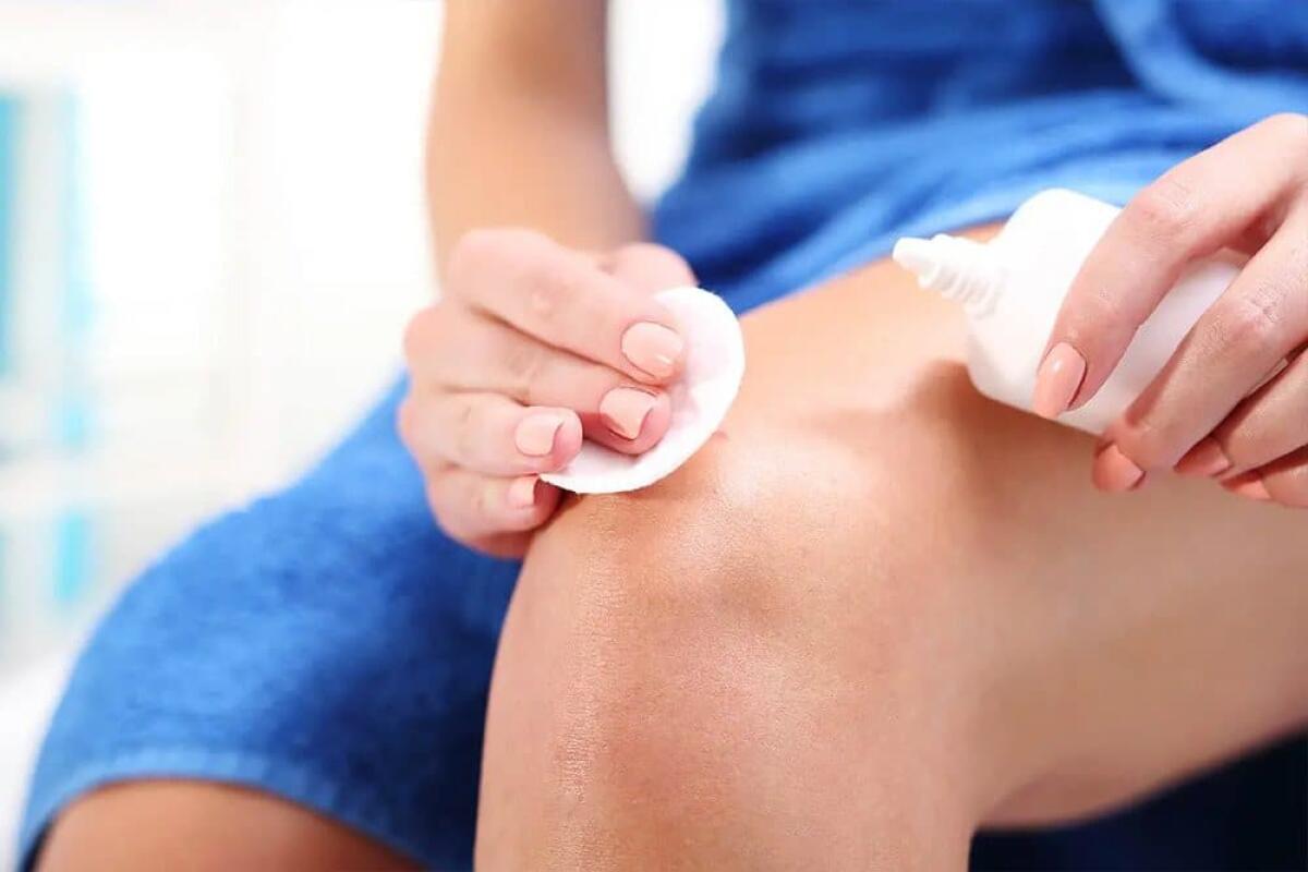 Connettivina: una linea di prodotti per guarire la pelle lesa - 
