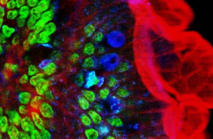 Credits: A. Diaspro, P. Bianchini, G. Vicidomini, M. Faretta, P. Ramoino and C. Usai. Multi-photon excitation microscopy. BioMedical Engineering OnLine, 2006