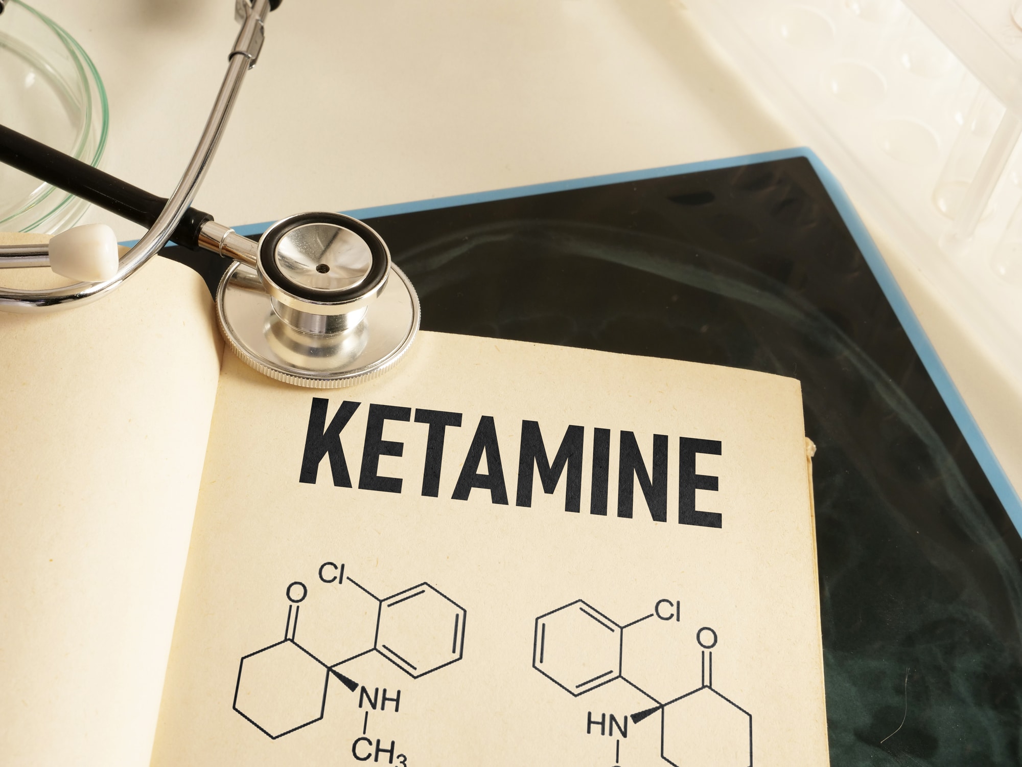 Ketamina: cos'è, utilizzo, effetti e rischi