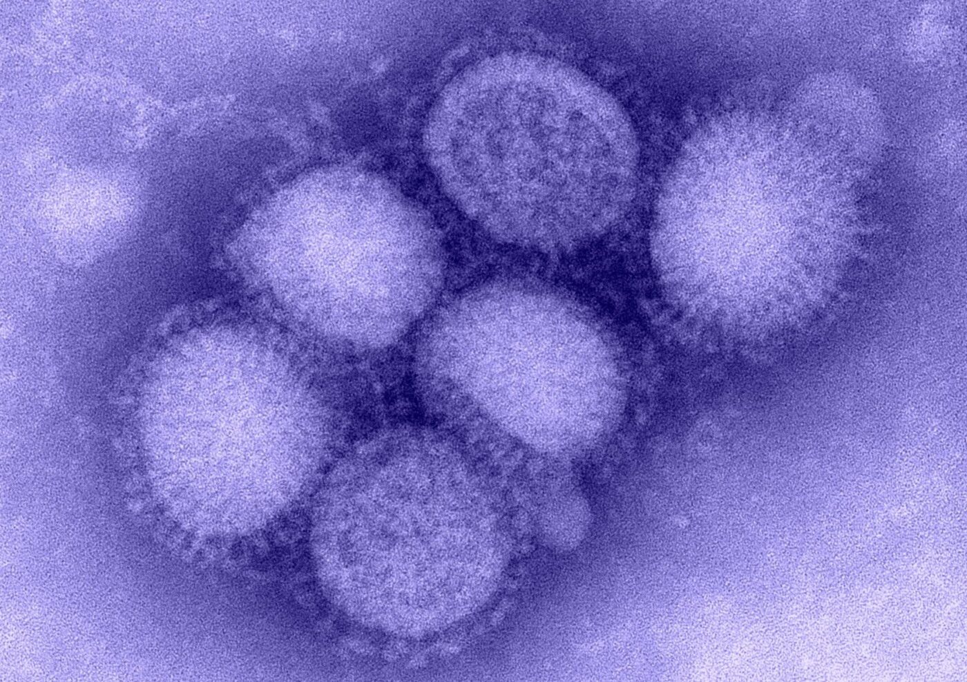 H1N1