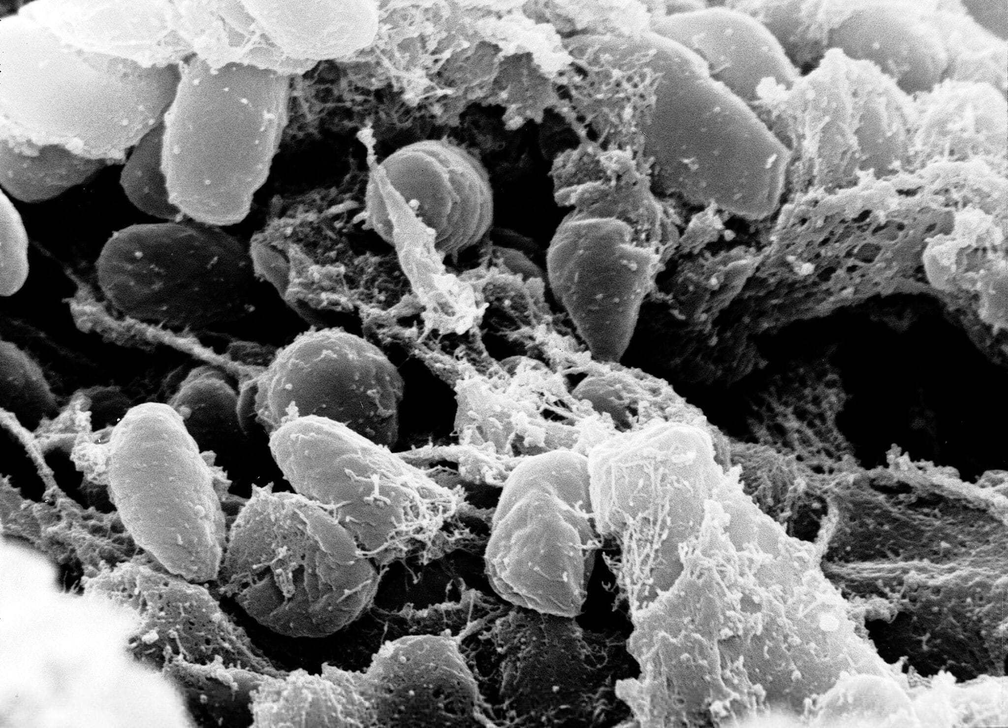Micrografia elettronica a scansione che ritrae una massa di batteri Yersinia pestis (la causa della peste bubbonica) nel proventricolo della pulce vettore. Credits: Ê Rocky Mountain Laboratories, NIAID, NIH.