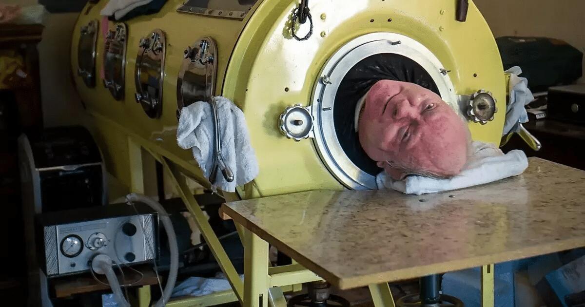 Paul Alexander è morto: l'uomo che ha vissuto per decenni dentro un polmone di acciaio aveva 78 anni - 