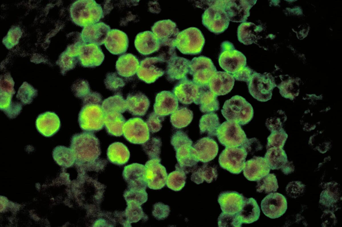 Ameba mangia-cervello o Naegleria fowleri: cos'è, sintomi dell'infezione e prevenzione - 