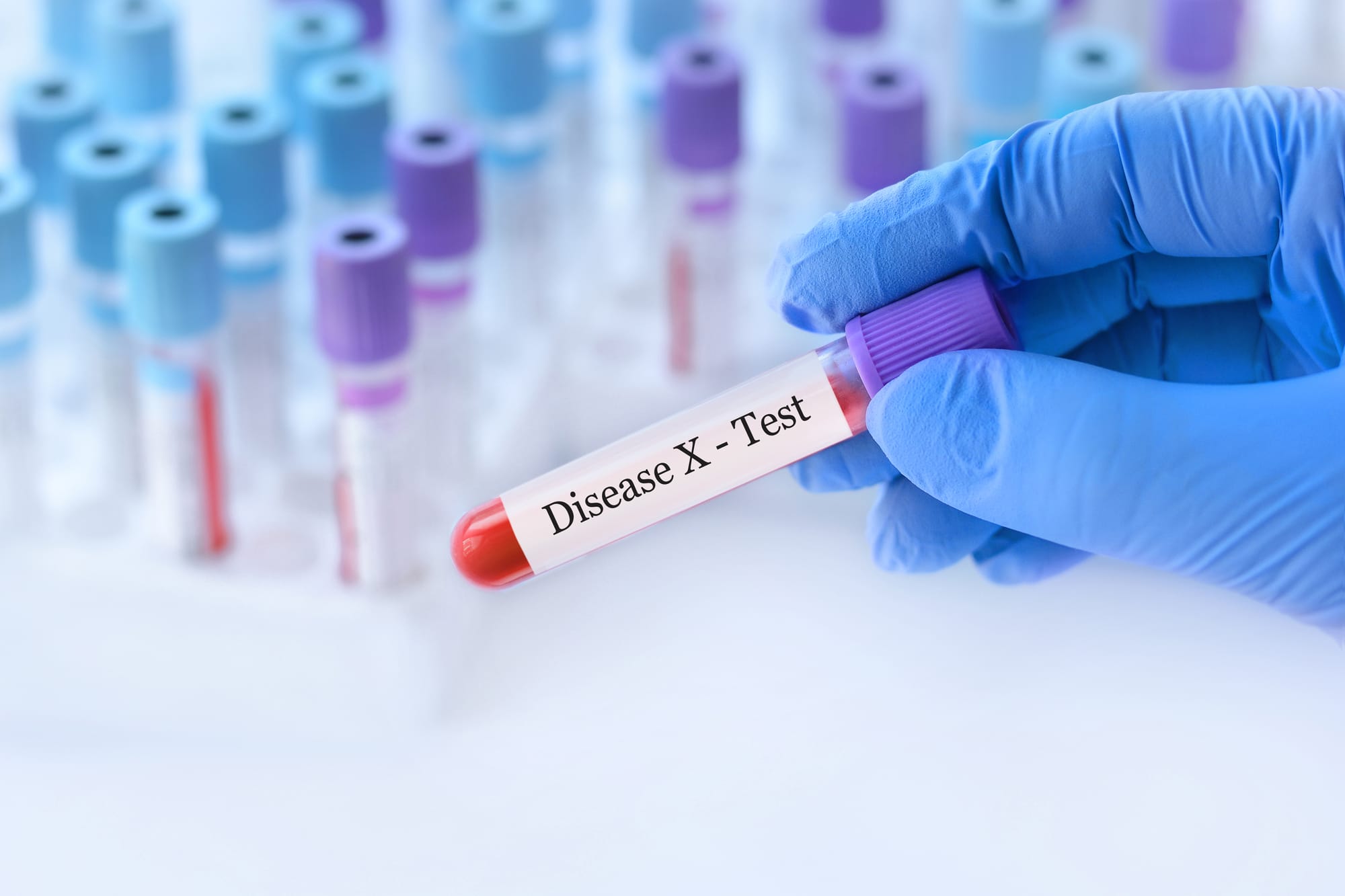 Doctor holding a test blood sample tube with Disease X test.The world is preparing for a new mysterious pandemic "Disease X" that can could cause much more deaths than the coronavirus pandemic