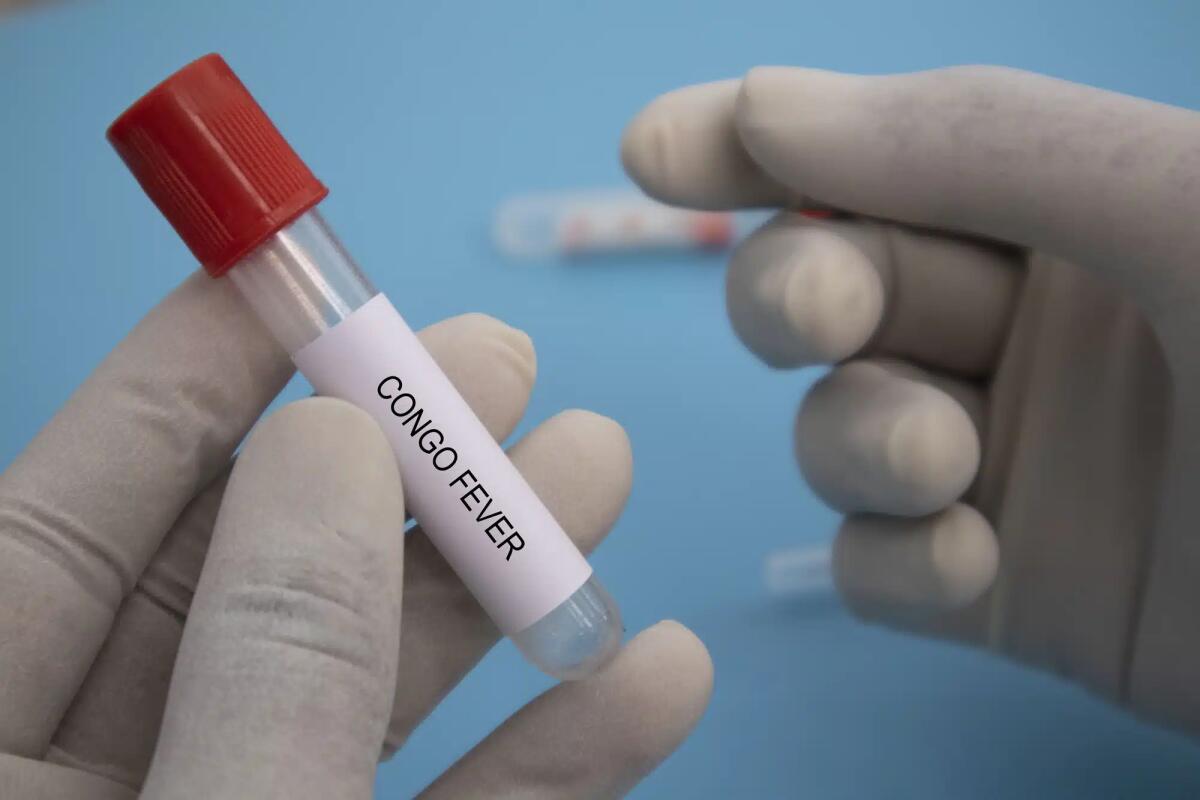 Studio italiano individua il meccanismo d'ingresso del virus della febbre emorragica Crimea-Congo - 