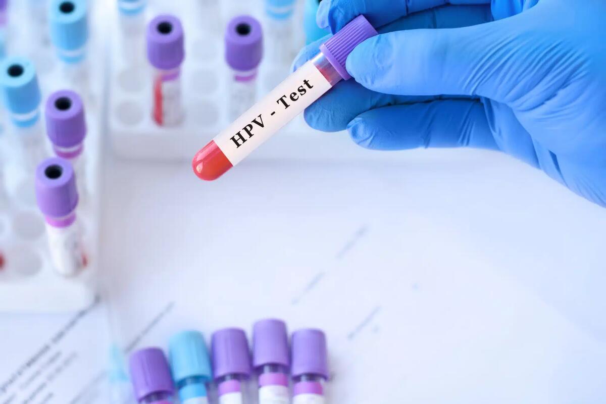 Un test innovativo rileva il DNA dell'HPV direttamente da un campione auto-prelevato - 
