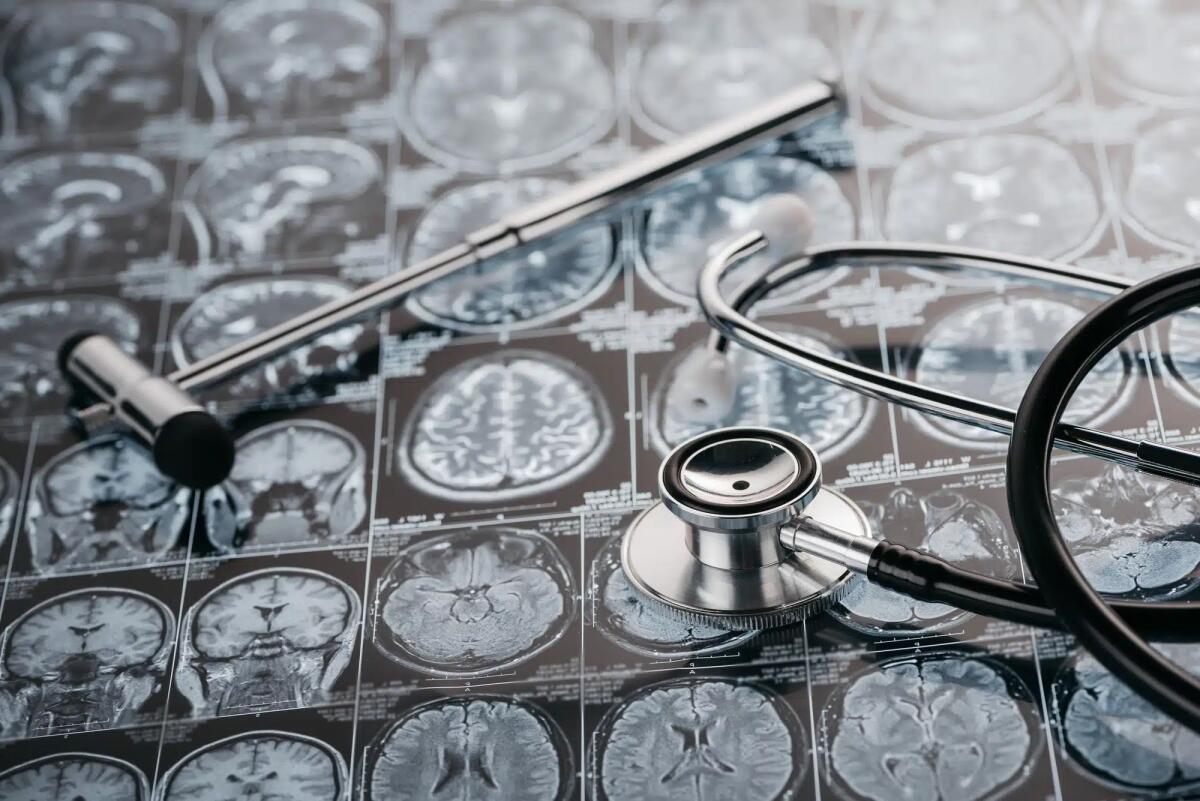 Un nuovo studio ha rilevato delle differenze nella microstruttura della materia bianca del cervello tra i sessi con l'utilizzo dell'AI - 