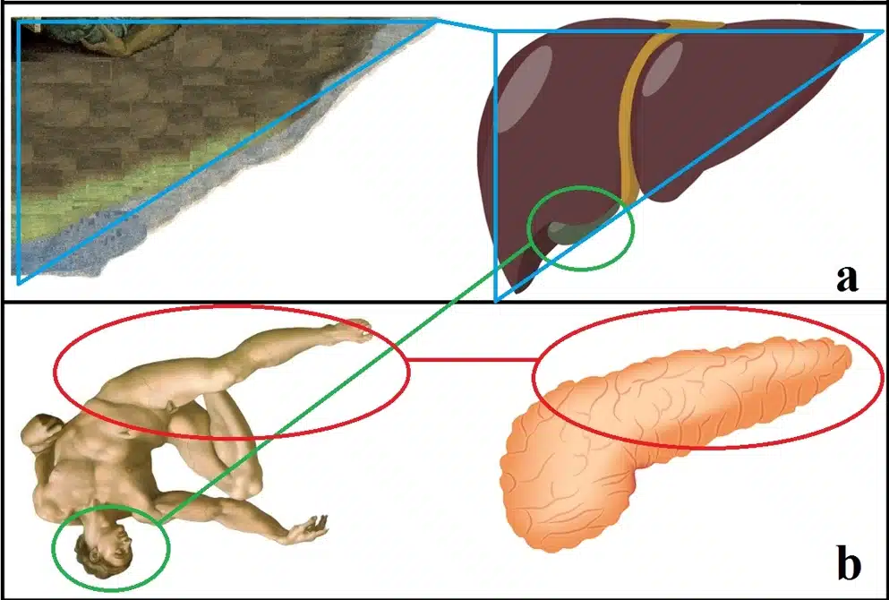 Immagine ripresa dall’articolo “Mirroring Michelangelo, finding Galen: the ancient anatomical theory of the soul and its possible influence on The Creation of Adam” · L. V. Messa