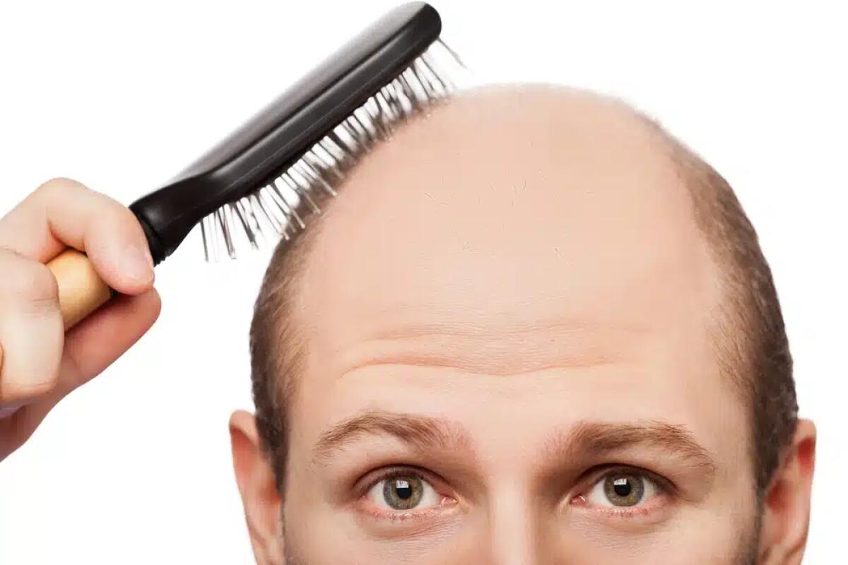 Come arrestare la caduta dei capelli - 