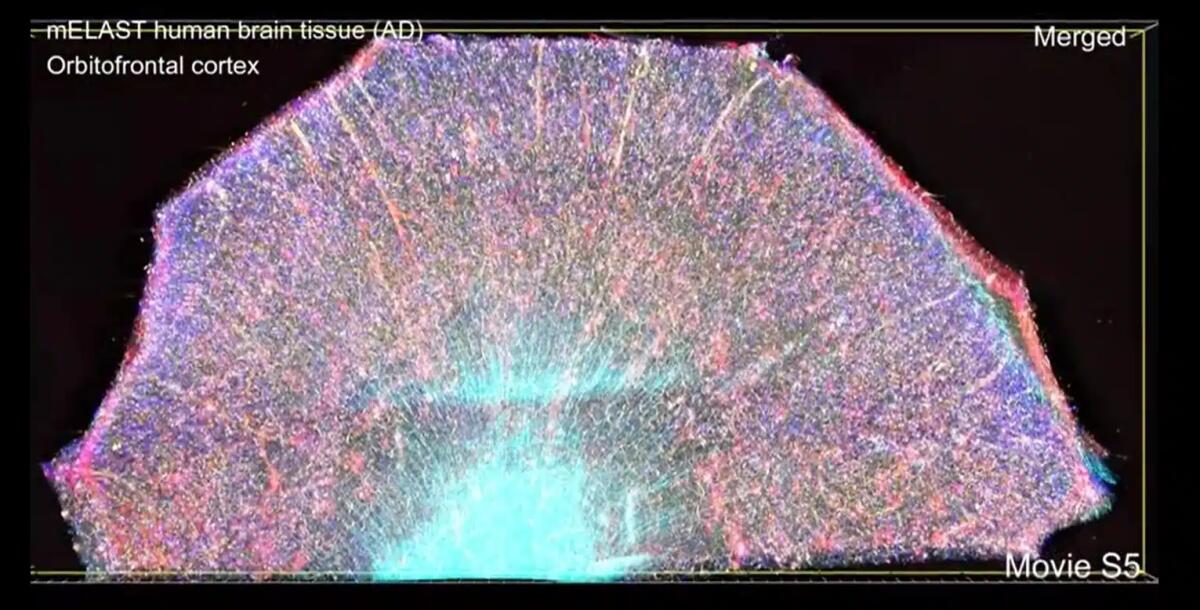 Dal MIT una rivoluzionaria piattaforma per vedere il cervello con una risoluzione senza precedenti - 