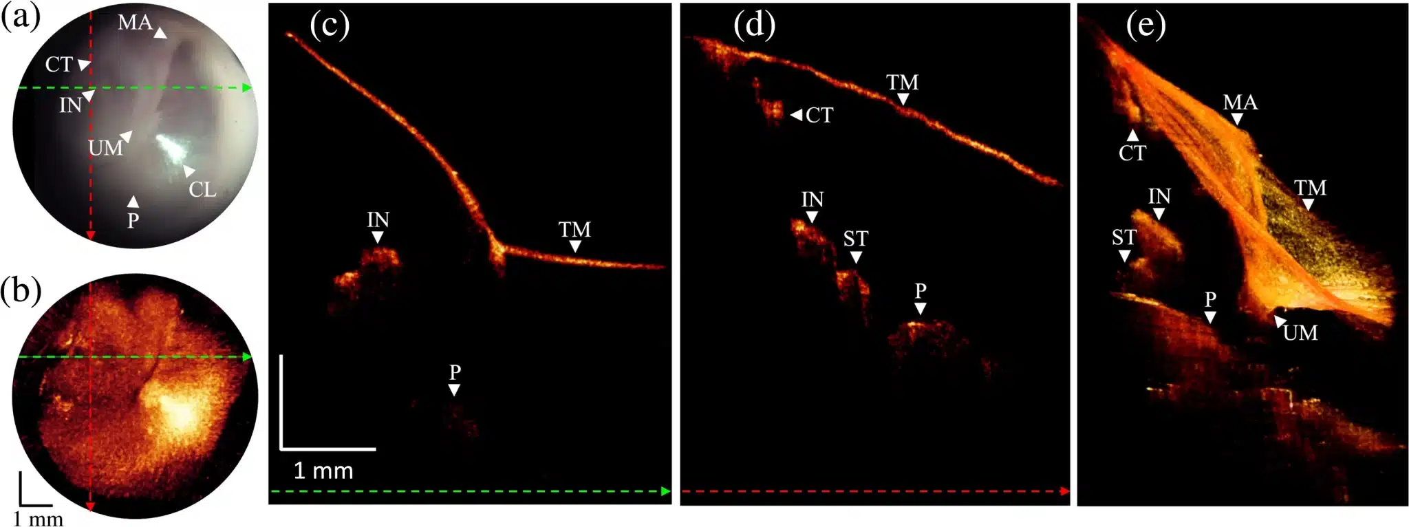 Immagine di un orecchio sano acquisita dell'otoscopio OCT durante i test che permette la visione della profondità - Credits: Journal of Biomedical Optics
