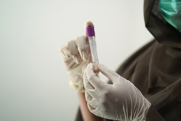 Illustrazione delle analisi del sangue (Pixabay FOTO) - www.biomedicalcue.it