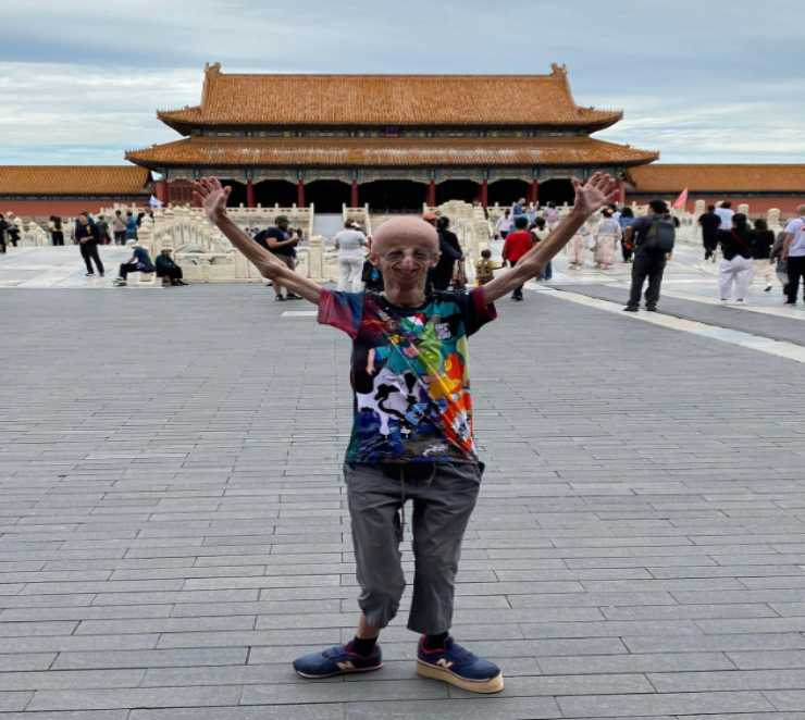 Sammy Basso in Cina (Instagram) - www.biomedicalcue.it
