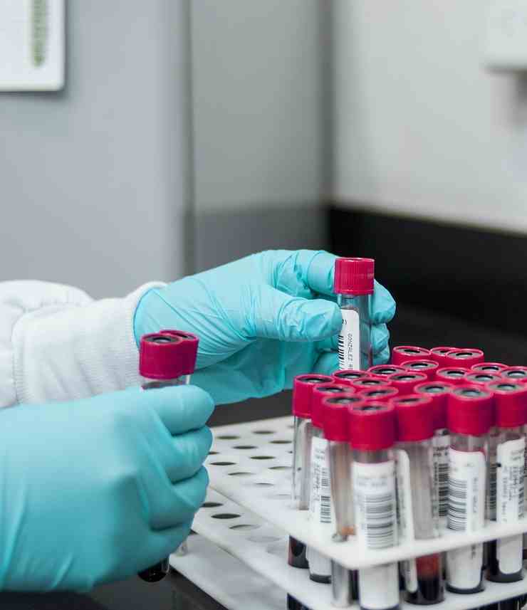 Laboratorio (Pixabay FOTO) - www.biomedicalcue.it