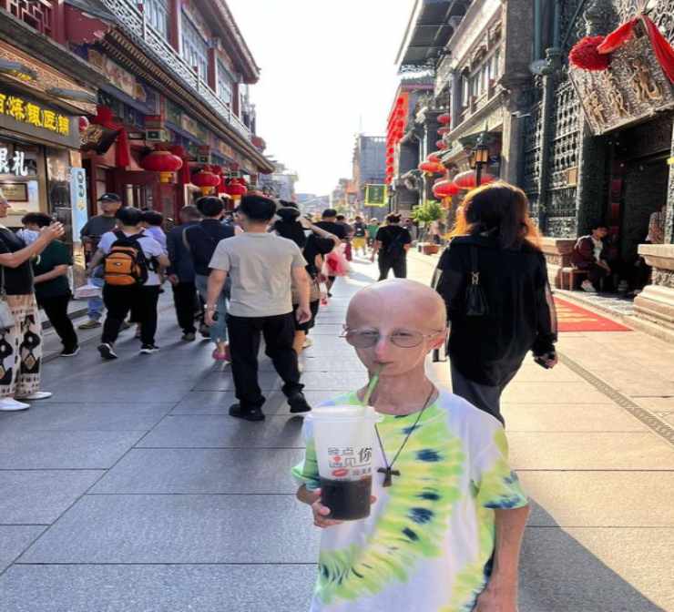 Sammy Basso visita in Cina (Instagram) www.biomedicalcue.it