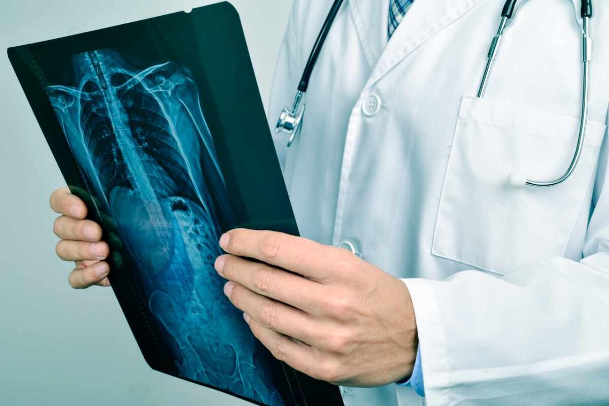 Radiografia alla colonna dorsale: in cosa consiste e quando è consigliata? - 