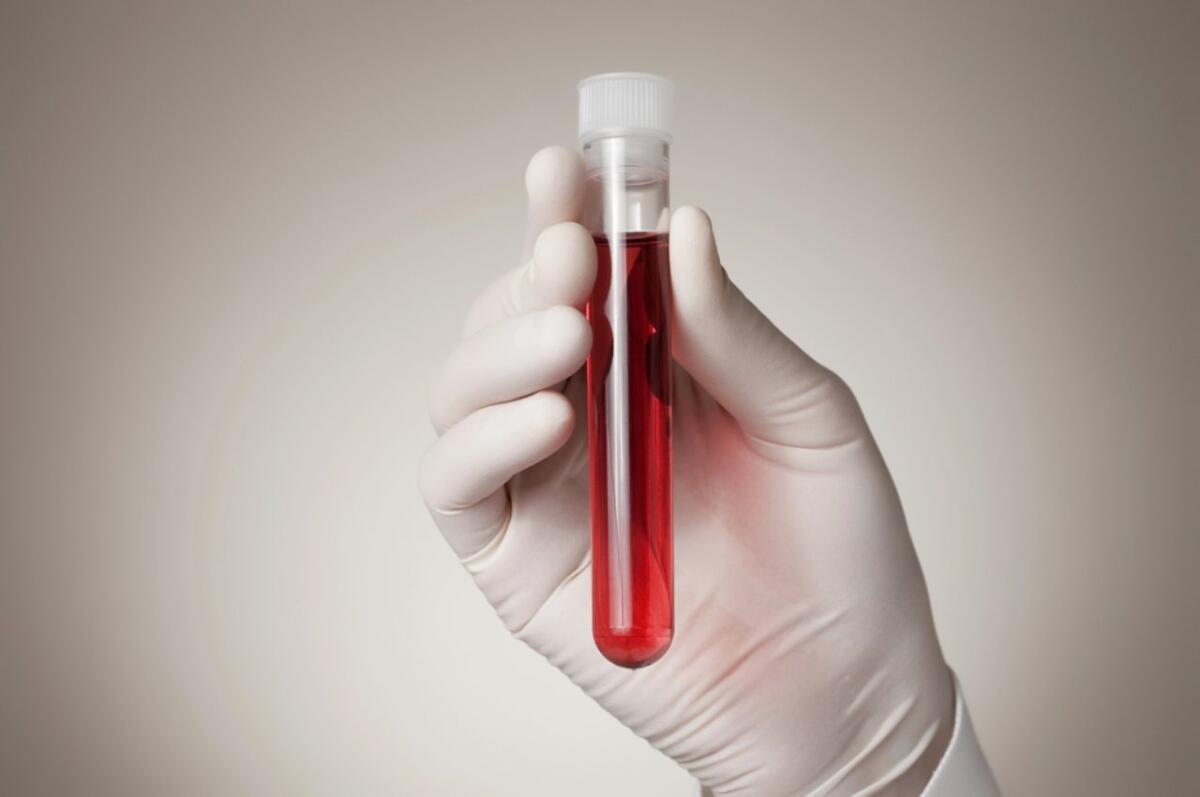 Profilo lipidico: un test importante per la propria salute cardiovascolare - 